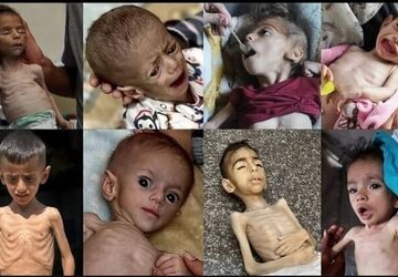 در غزه گرسنگی وجود ندارد!