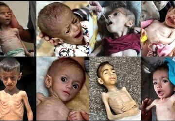 در غزه گرسنگی وجود ندارد!