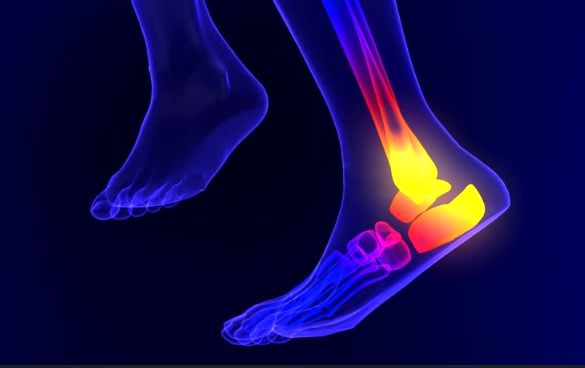 بی‌حسی پاها؛ زنگ خطر بیماری‌های جدی عصبی و عروقی