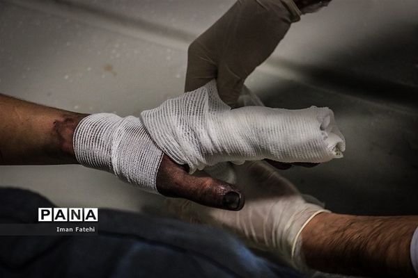 چهارشنبه سوزی