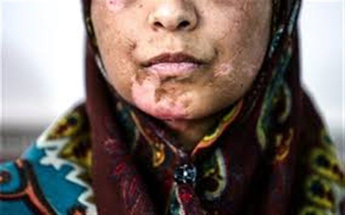 دلیل تعلل قوه قضاییه در ارسال لایحه «تامین امنیت زنان در برابر خشونت» به مجلس چیست