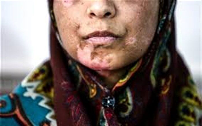 محمودی، نماینده مجلس: در صورت تعلل قوه قضاییه، لایحه خشونت علیه زنان در قالب طرح پیگیری می‌شود