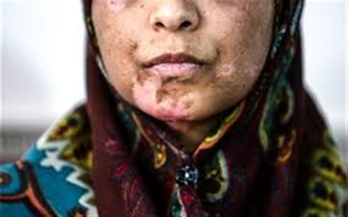 محمودی، نماینده مجلس: در صورت تعلل قوه قضاییه، لایحه خشونت علیه زنان در قالب طرح پیگیری می‌شود