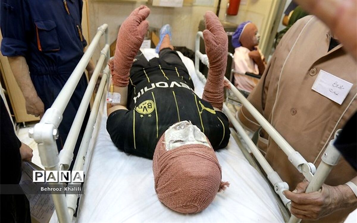 قطع عضو و کوری از عوارض حوادث چهارشنبه آخر سال