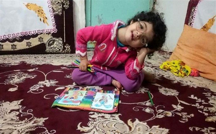 سپاه هزینه درمان   تنها کودک ایرانی مبتلا به «سندرم هنکام»  را تقبل کرد