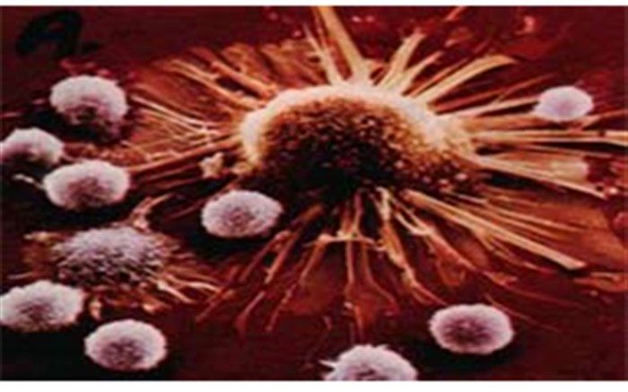 مهمترین شاخصی که سرنوشت بیمار را بعد از تشخیص سرطان تعیین می‌کند