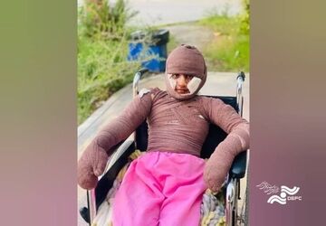 «هدا»، دختری از میناب/ مستندی درباره یکی از بازماندگان جنگ رمضان