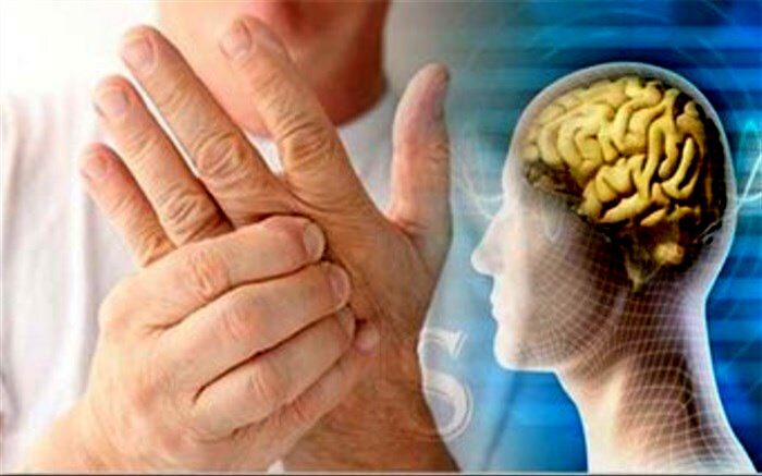 زنان بیشترین مبتلایان به ام.اس