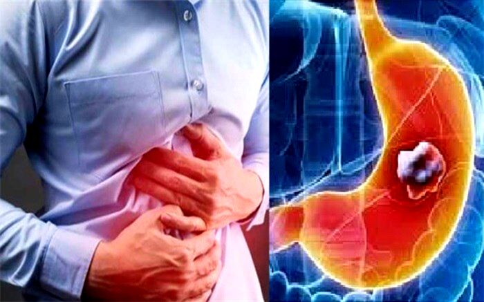 چند توصیه برای روزه‌داری مبتلایان به ریفلاکس معده