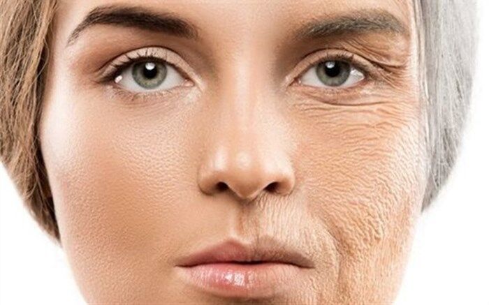 چرا زن‌ها زودتر از مردها پیر می‌شوند