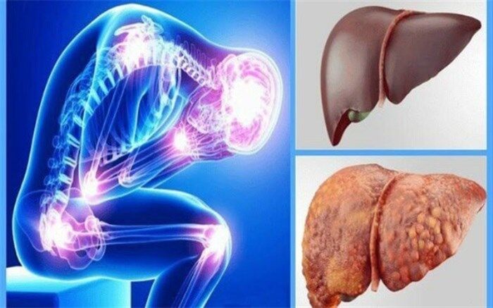 درمان کبد چرب با کمک این دانه‌‌های معجزه‌آسا!