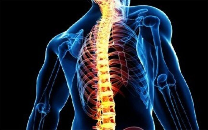 اسکولیوز؛ رایج‌ترین اختلال ستون فقرات