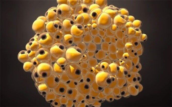 ابداع روشی جدید برای مقابله با سرطان سینه