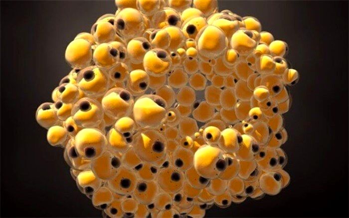 ابداع روشی جدید برای مقابله با سرطان سینه