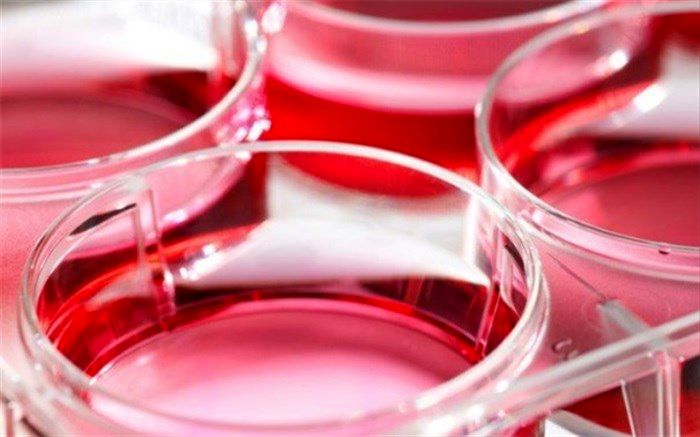 چگونه استرس مزمن منجر به آسیب مغزی می‌شود