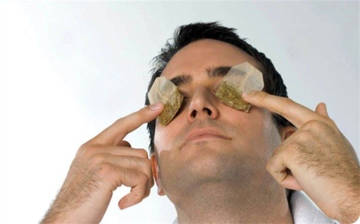 تـورم زیـرچشـم را جدی بگیـریم