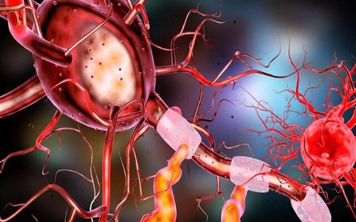 شناسایی فرآیندی که در بروز بیماری آلزایمر موثر است