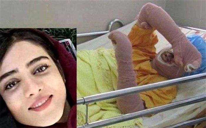 آسیب‌‌شناسی حقوقی‌ و اجتماعی یک خودسوزی