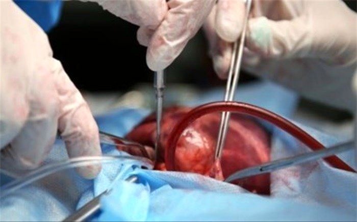 اهدای عضو، ۴۰ درصد افزایش یافت