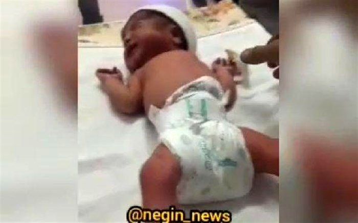 معاون سازمان نظام پرستاری: درباره خبر «قطع انگشت نوزاد بیمارستان نور شهریار» اغراق صورت گرفته است