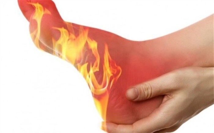 سندروم پای بی قرار چیست و چه درمانی دارد