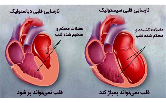 ۵ توصیه برای کسانی‌که مبتلا به نارسایی قلبی هستند