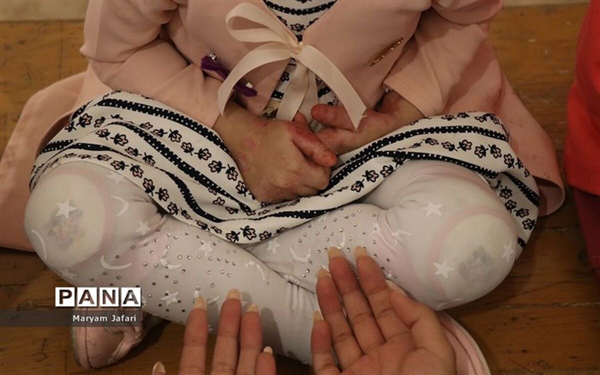 مرگ ۱۵ کودک ای‌بی به علت تحریم پانسمان میپلکس