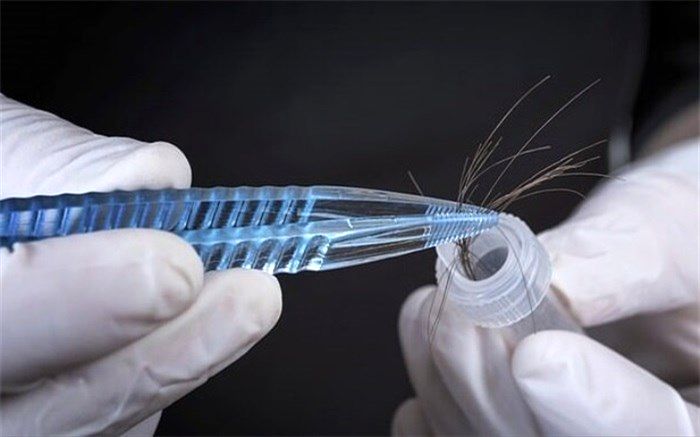 دانستنی‌هایی درباره تزریق ژل و چربی به بدن