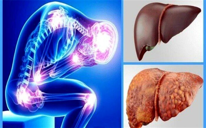 معجزه‌ای که کبدتان را از کار می‌اندازد