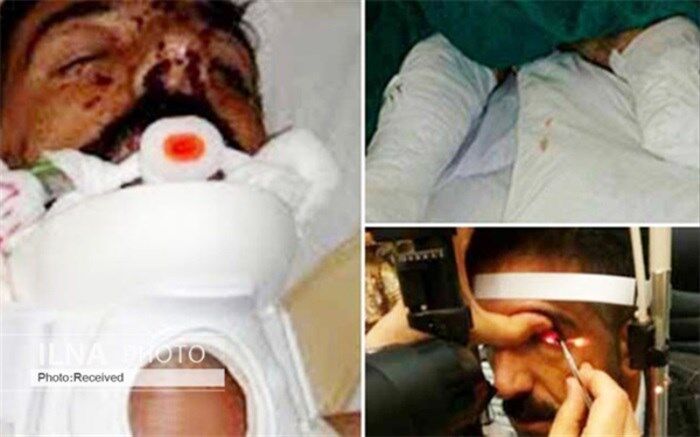 «مردم» برای لقمان وحید، سوی چشم و پای مصنوعی جور کردند