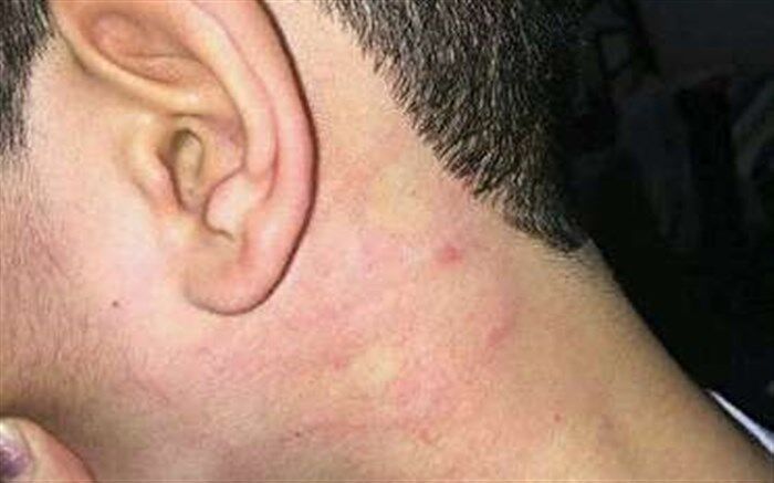 اخراج عامل ضرب و شتم دانش آموز تبریزی