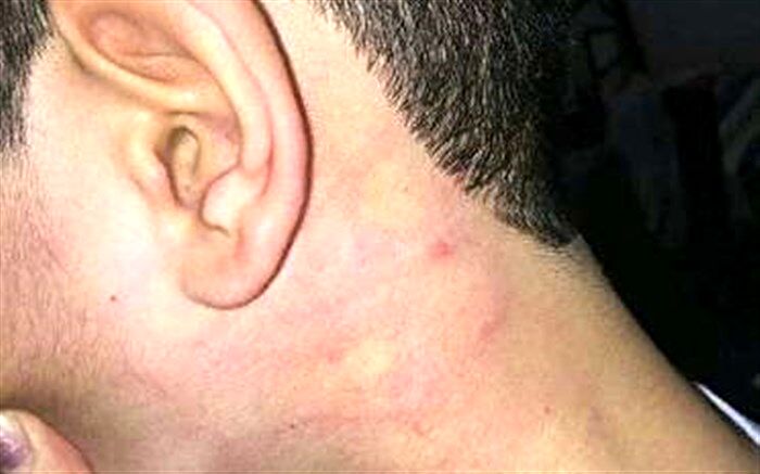 اخراج عامل ضرب و شتم دانش آموز تبریزی