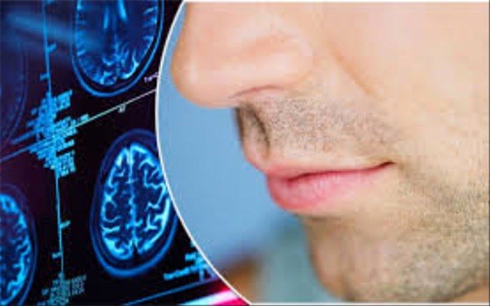 شیوع اختلال بویایی و احتمال ارتباط با کرونا