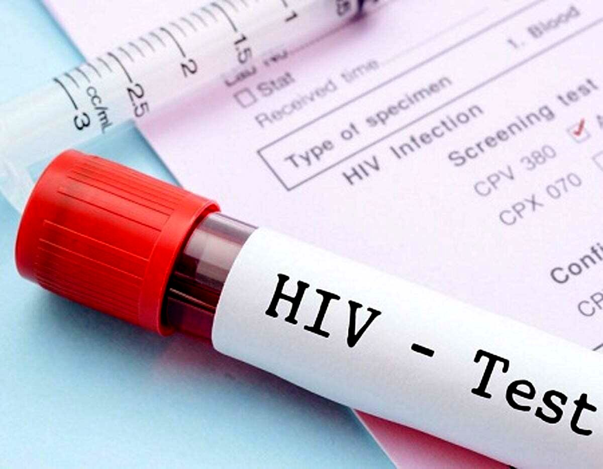 در پویش"من هم تست HIV می‌دهم " به دنبال اطلاع‌رسانی همگانی هستیم
