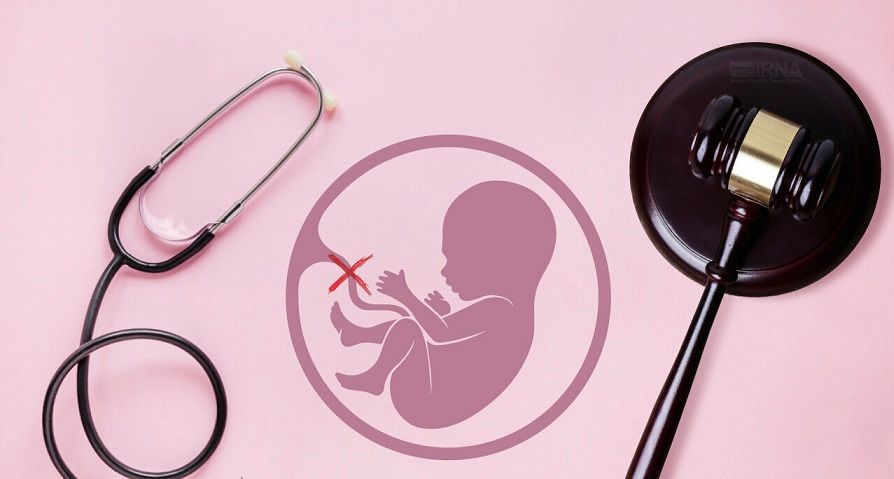سامانه ثبت سقط‌ جنین‌های قانونی راه‌اندازی شد